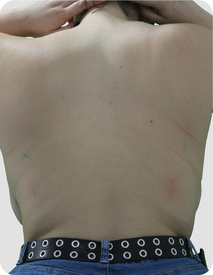 B_A_patient-21_before.webp