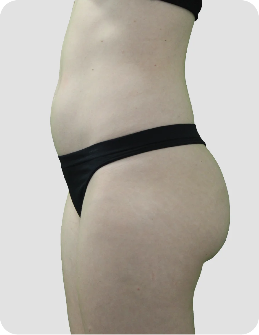 B_A_patient-22_before.webp