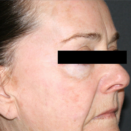 tribella_en_2_after_33.jpg