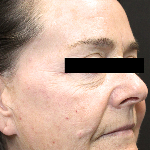 tribella_en_2_before_2.jpg
